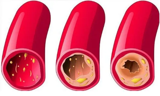 H-tea (incelemeler 2025) 💊 yorumlar 💊 nereden alınır 💊 Türkiye 💊 fiyat.